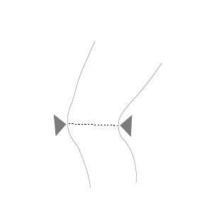 Deluxe Hinged Knee Brace