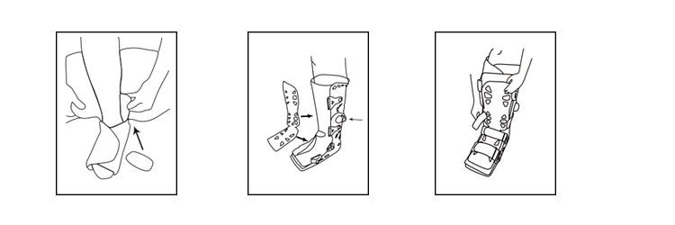 Pneumatic Walking Boot Instructions